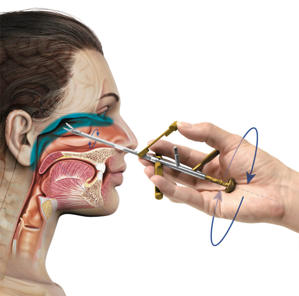 鼻粘膜縫合用持針器の製品画像